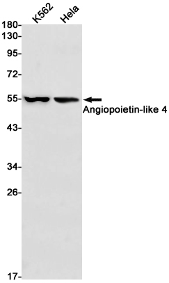 Rabbit Monoclonal Antibody to Angiopoietin Like 4