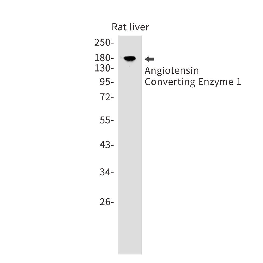Rabbit Monoclonal Antibody to Angiotensin Converting Enzyme 1