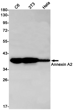 Rabbit Monoclonal Antibody to Annexin A2