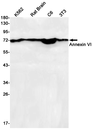 Rabbit Monoclonal Antibody to Annexin VI