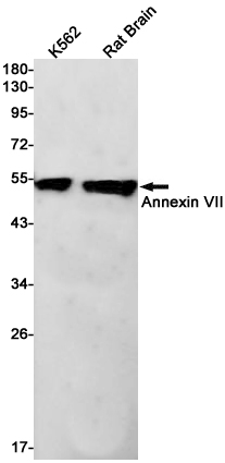 Rabbit Monoclonal Antibody to Annexin VII