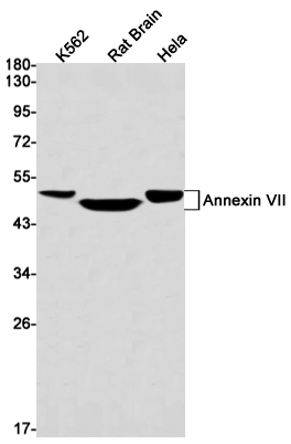 Rabbit Monoclonal Antibody to Annexin VII