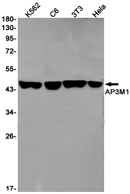Rabbit Monoclonal Antibody to AP3M1