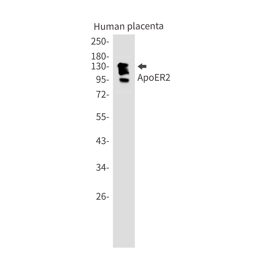 Rabbit Monoclonal Antibody to ApoER2