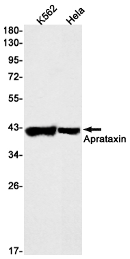 Rabbit Monoclonal Antibody to Aprataxin