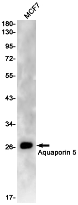 Rabbit Monoclonal Antibody to Aquaporin 5