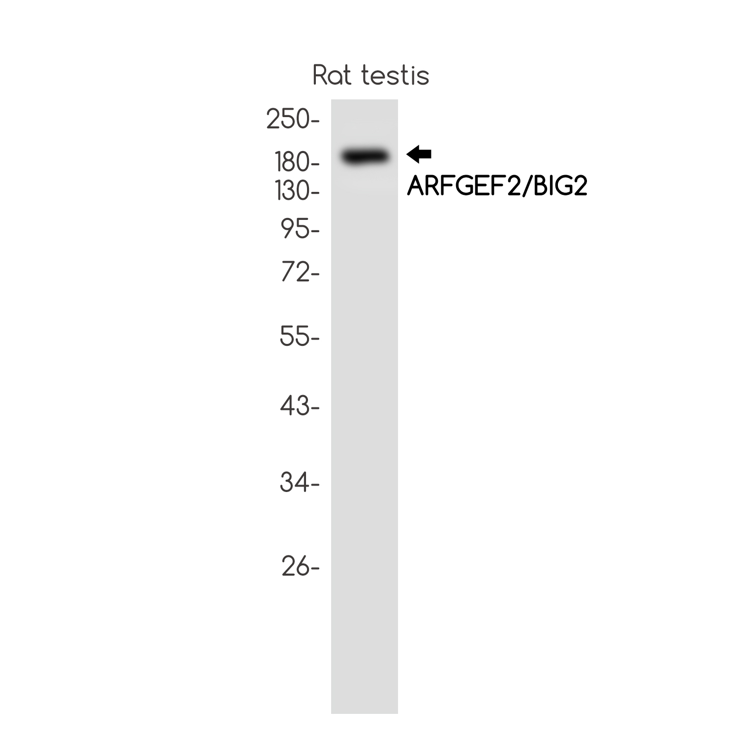 Rabbit Monoclonal Antibody to ARFGEF2