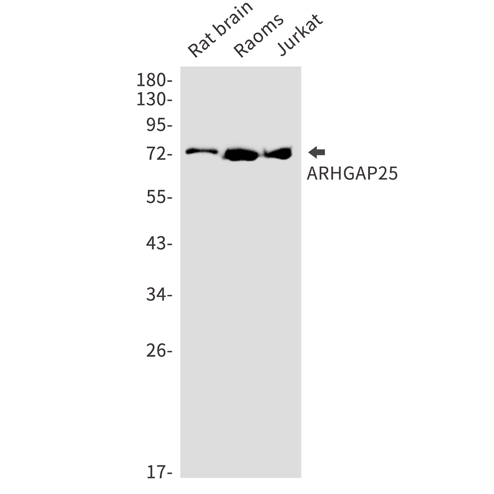 Rabbit Monoclonal Antibody to ARHGAP25