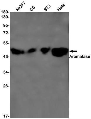 Rabbit Monoclonal Antibody to Aromatase