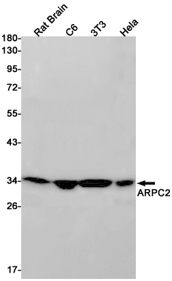 Rabbit Monoclonal Antibody to ARPC2