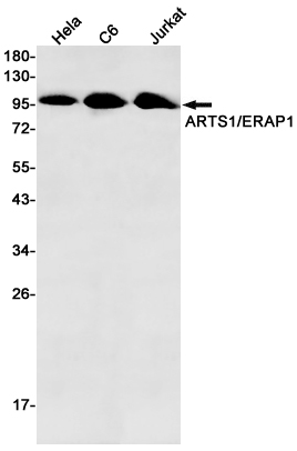 Rabbit Monoclonal Antibody to ERAP1
