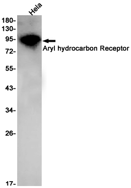 Rabbit Monoclonal Antibody to Aryl Hydrocarbon Receptor