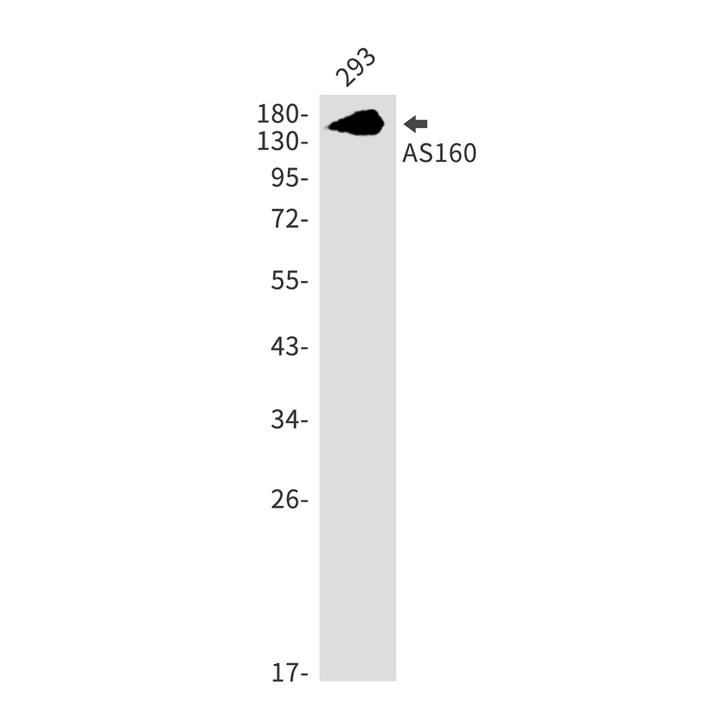 Rabbit Monoclonal Antibody to AS160