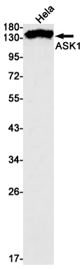Rabbit Monoclonal Antibody to ASK1