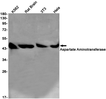 Rabbit Monoclonal Antibody to Aspartate Aminotransferase
