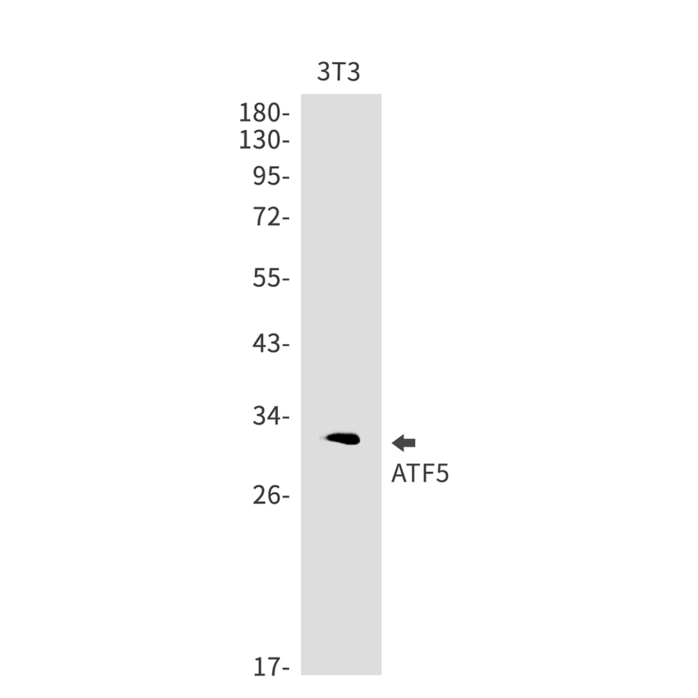 Rabbit Monoclonal Antibody to ATF5