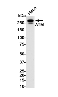 Rabbit Monoclonal Antibody to ATM