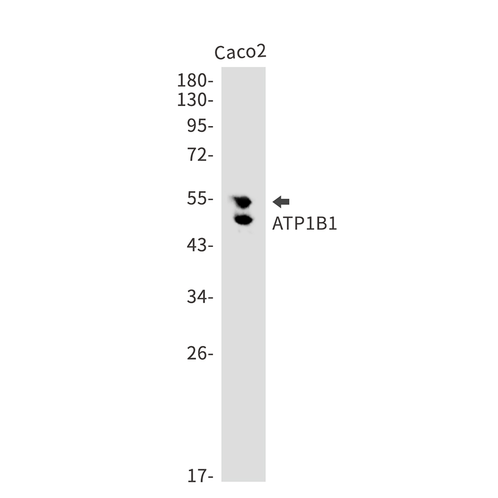 Rabbit Monoclonal Antibody to ATP1B1