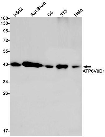 Rabbit Monoclonal Antibody to ATP6V0D1