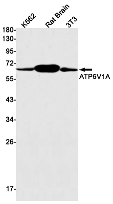Rabbit Monoclonal Antibody to ATP6V1A