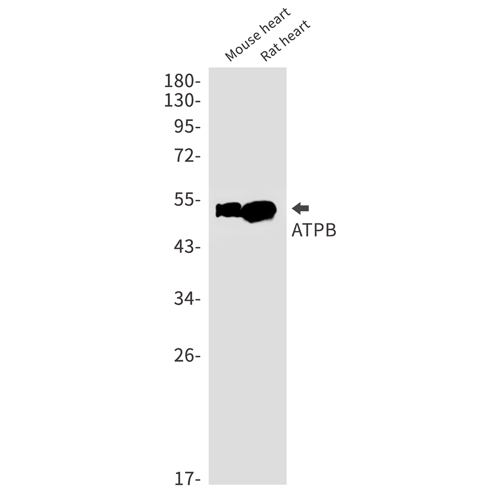 Rabbit Monoclonal Antibody to ATPB