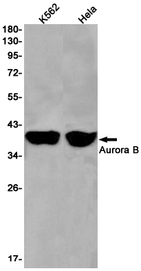 Rabbit Monoclonal Antibody to Aurora B
