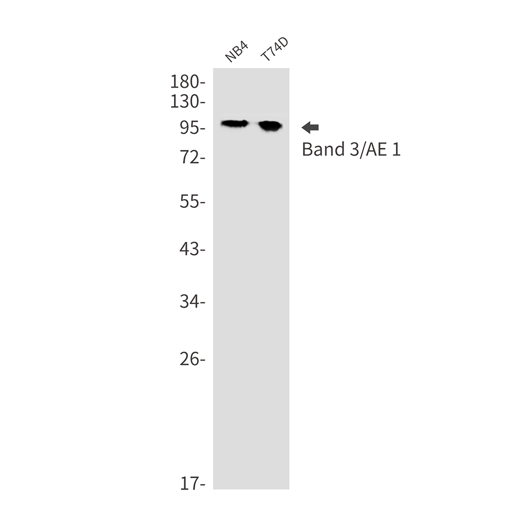 Rabbit Monoclonal Antibody to Band 3