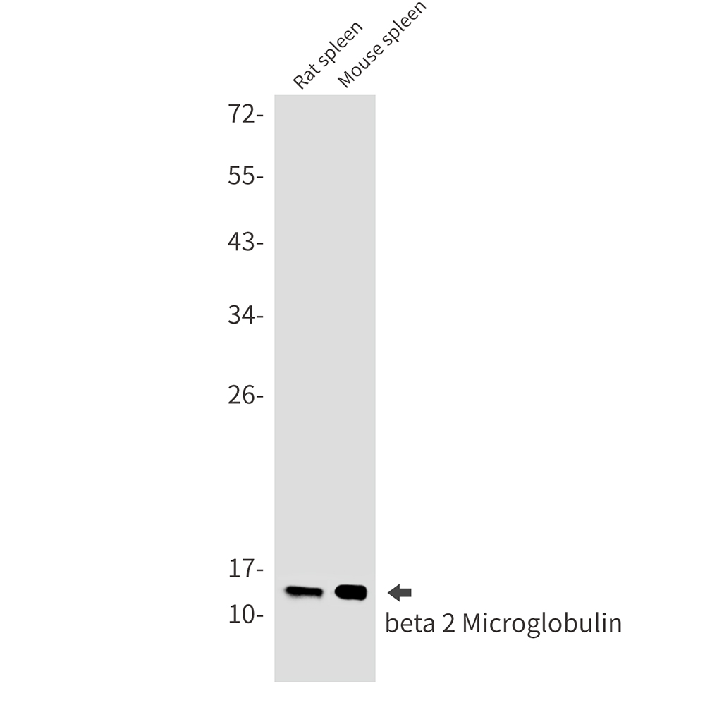 Rabbit Monoclonal Antibody to beta 2 Microglobulin
