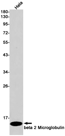 Rabbit Monoclonal Antibody to beta 2 Microglobulin