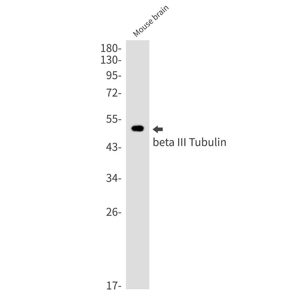 Rabbit Monoclonal Antibody to beta III Tubulin