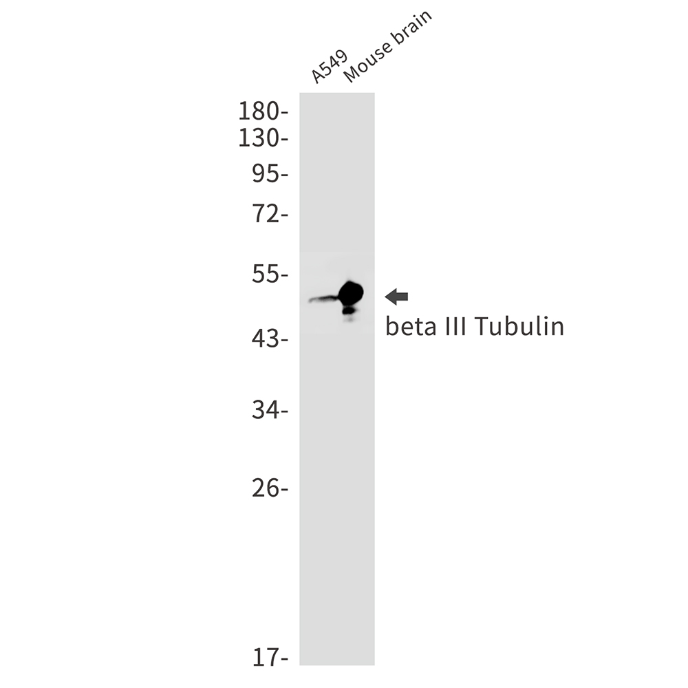 Rabbit Monoclonal Antibody to beta III Tubulin
