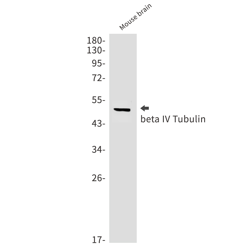 Rabbit Monoclonal Antibody to beta IV Tubulin