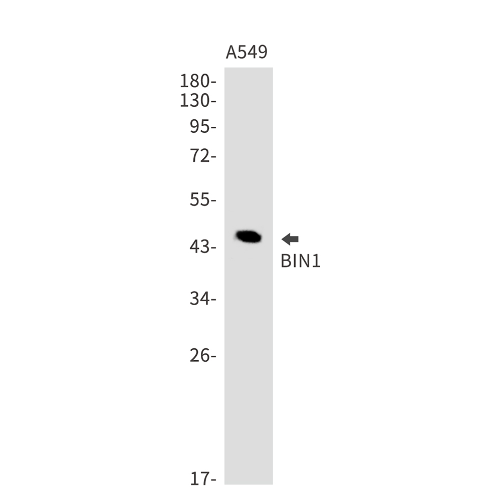 Rabbit Monoclonal Antibody to BIN1