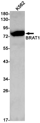 Rabbit Monoclonal Antibody to BRAT1