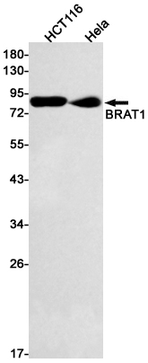 Rabbit Monoclonal Antibody to BRAT1