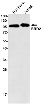 Rabbit Monoclonal Antibody to BRD2