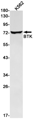 Rabbit Monoclonal Antibody to BTK
