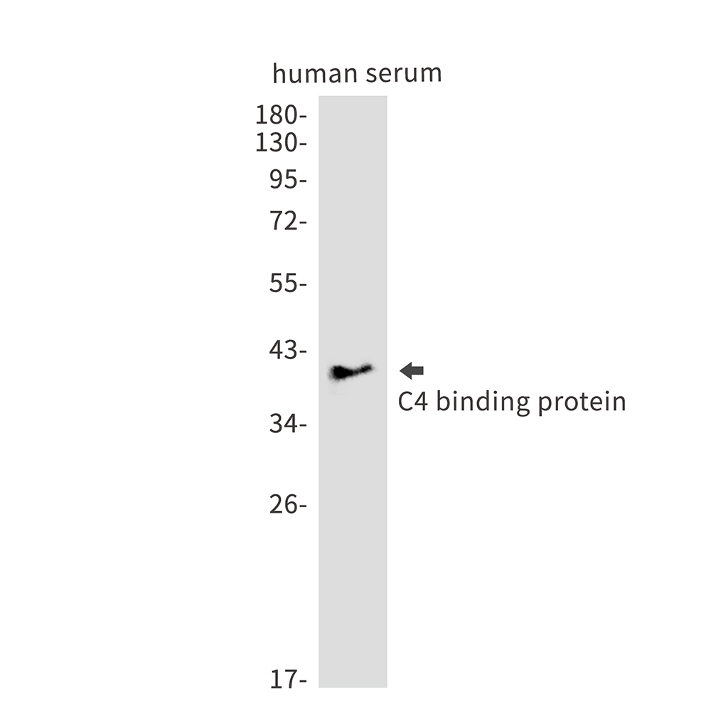 Rabbit Monoclonal Antibody to C4 Binding Protein