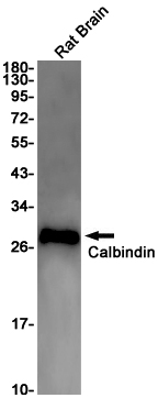Rabbit Monoclonal Antibody to Calbindin