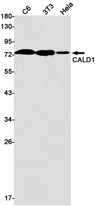 Rabbit Monoclonal Antibody to Caldesmon