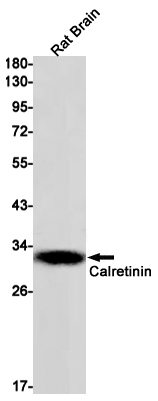 Rabbit Monoclonal Antibody to Calretinin