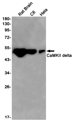 Rabbit Monoclonal Antibody to CaMKII delta