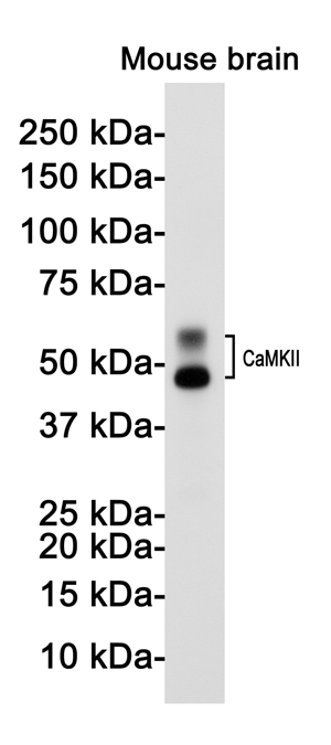 Rabbit Monoclonal Antibody to CaMKII beta