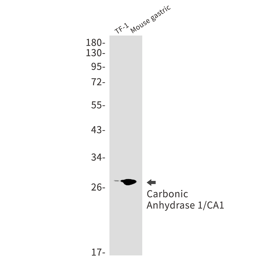 Rabbit Monoclonal Antibody to Carbonic Anhydrase 1