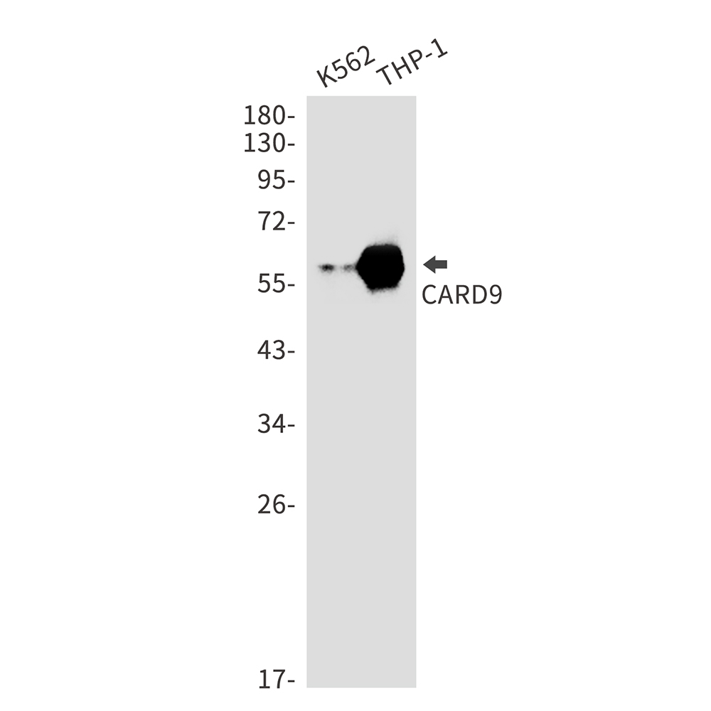 Rabbit Monoclonal Antibody to CARD9