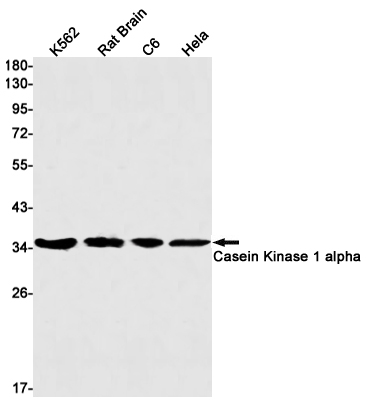 Rabbit Monoclonal Antibody to Casein Kinase 1 alpha