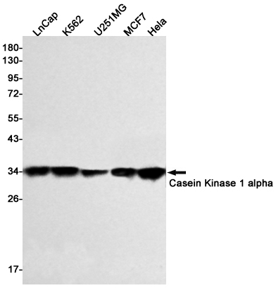 Rabbit Monoclonal Antibody to Casein Kinase 1 alpha