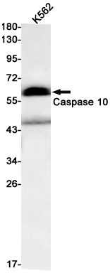 Rabbit Monoclonal Antibody to Caspase 10