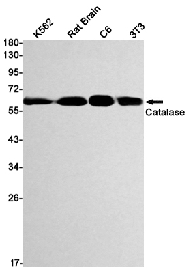 Rabbit Monoclonal Antibody to Catalase