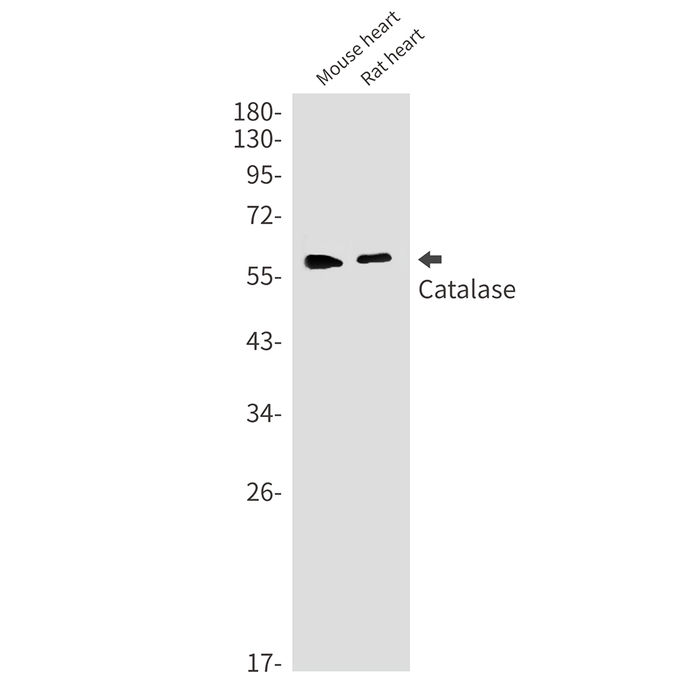 Rabbit Monoclonal Antibody to Catalase